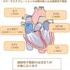 カテーテルアブレーション