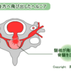 ヘルニア術後経過報告書