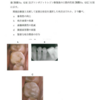 117回歯科医師国家試験【117D-45】保存修復学：直接法と間接法の比較