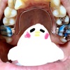 歯列矯正1ヶ月　拡大装置