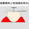 一目でわかる！咬頭展開角と咬頭傾斜角の違い