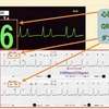 ECG-196：answer