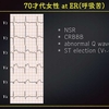 ECG-253：answer