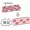 アスリートは貧血になりやすい!?