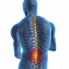 What Is Back Pain?