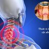 Chấn thương cột sống đâu là nguyên nhân và cách phòng tránh