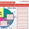ECG-367：VT診断のためのTips その2= 心電図検定試験：傾向と対策 Q.014=