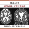 パーキンソン病を科学する