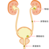 尿路(尿管)結石って？？