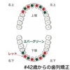 【調整10回目】ゴムかけのめんどくささに心折れかける