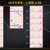 ECG-337：answer(1/2)