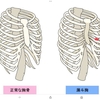 左の乳首の下が凹むと、不正脈起きる