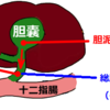 胆石