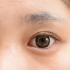 瞼のたるみを取る整形手術の基本知識