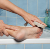 Cracked Heels Diagnosis And Treatment
