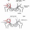 股関節の痛みが改善します！