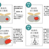 限局性前立腺癌に対する治療選択・治療効果についてまとめました。初学者向け