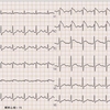 ECG-169：answer