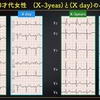 ECG-286：answer