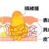 たかが吹出物　　