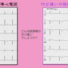 【コラム-140】：ECG Yellow web Book-006-肢誘導の付け違い問題- T-S method-その5】📕→📘→📙