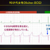ECG-359：answer:その2　 房室解離のその他= 心電図検定試験：傾向と対策 Q.007 =