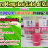 Obat Gatal Dan Eksim atau Eczema