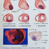 ❮心臓疾患❯