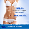 Vaser liposuction – A glance at the procedure 