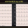 ECG-264：answer