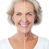 ピーリングで明るい肌つくりは老け顔対策に有効！