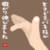 ときどきバネ指が曲がり伸びました