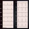 【ECG-186】動悸があって、この心電図ならば。。