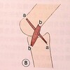 カウンターストレインによる筋紡錘の誤作動を正したいとき、逆さぶら下がり健康器をつかったら成果が高まった理由﻿