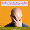 Hair Transplant Cost and Factors That Cause Variation