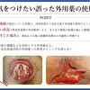 褥瘡を科学する