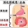 血便の理由、ベスト6