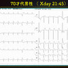 ECG-307；70才代男性。何となく胸苦しくて、ふらっとするんで来てみました。