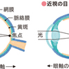 近視の基本的なおはなし。