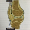 膝蓋下脂肪体：疼痛増幅装置