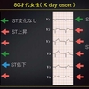 ECG-279：answer