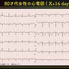 ECG-210：answer(その3)