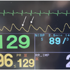 症例70：全身倦怠感を訴える76歳男性（J Emerg Med. 2020 Dec;59(6):938-939.）