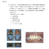 116回歯科医師国家試験【116A-73】義歯：長期使用した義歯の対応編