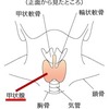 海藻の発がん性リスク？