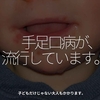 1461食目「手足口病が、流行しています。」子どもだけじゃない大人もかかります。