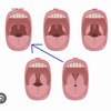 息子の扁桃腺 その後