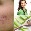 Experience acne and blemish effectively in 2 weeks