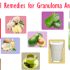 Natural Remedies for Granuloma Annulare