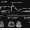 ラジハ8話　虫垂腫瘍